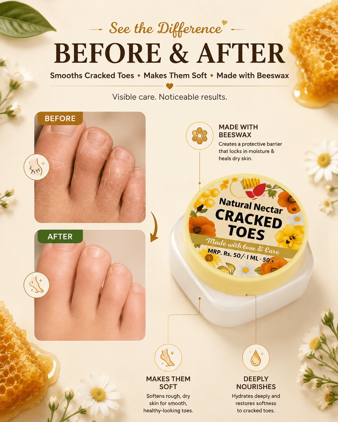 Natural Nectar Beeswax Cracked Heel & Toe Cream in lifestyle composition with foot care elements.